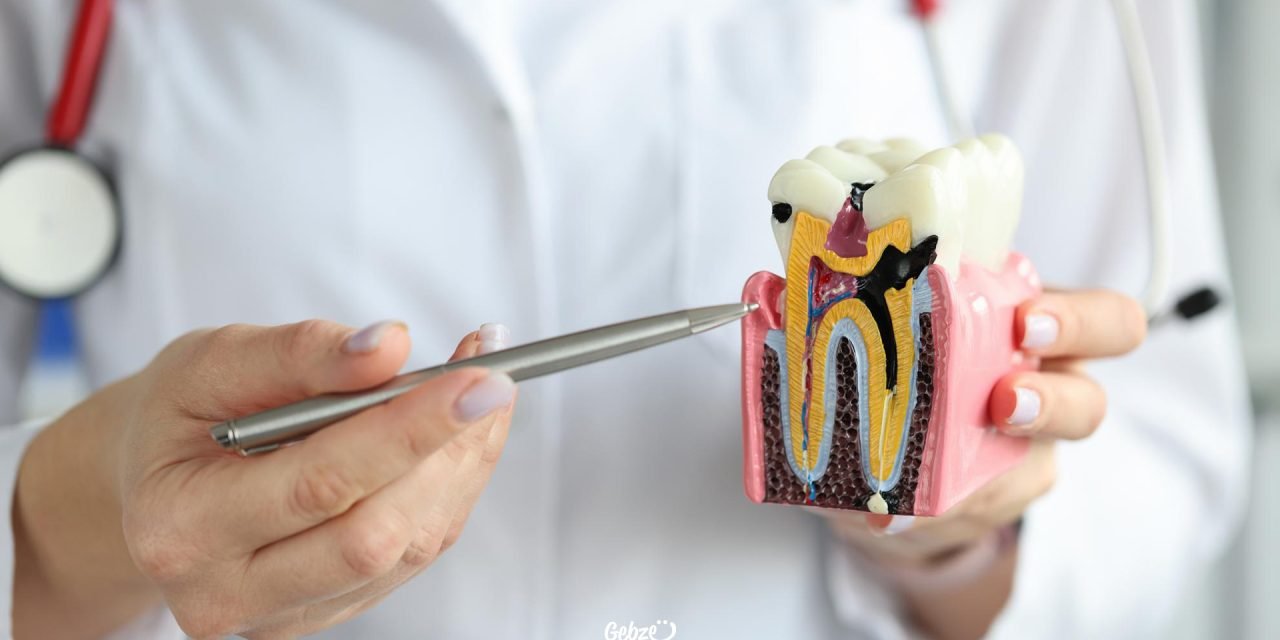 How Long Does a Dental Root Canal Treatment Take?