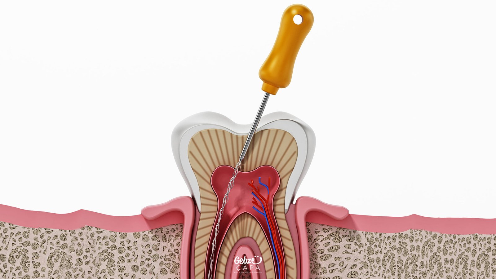 How Long Does a Dental Root Canal Treatment Take?