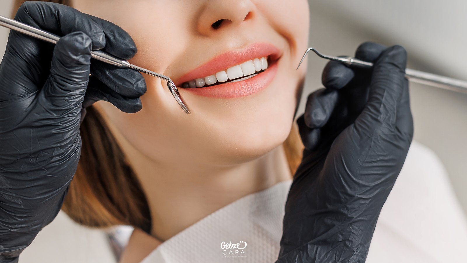 How Long Does a Dental Filling Take?