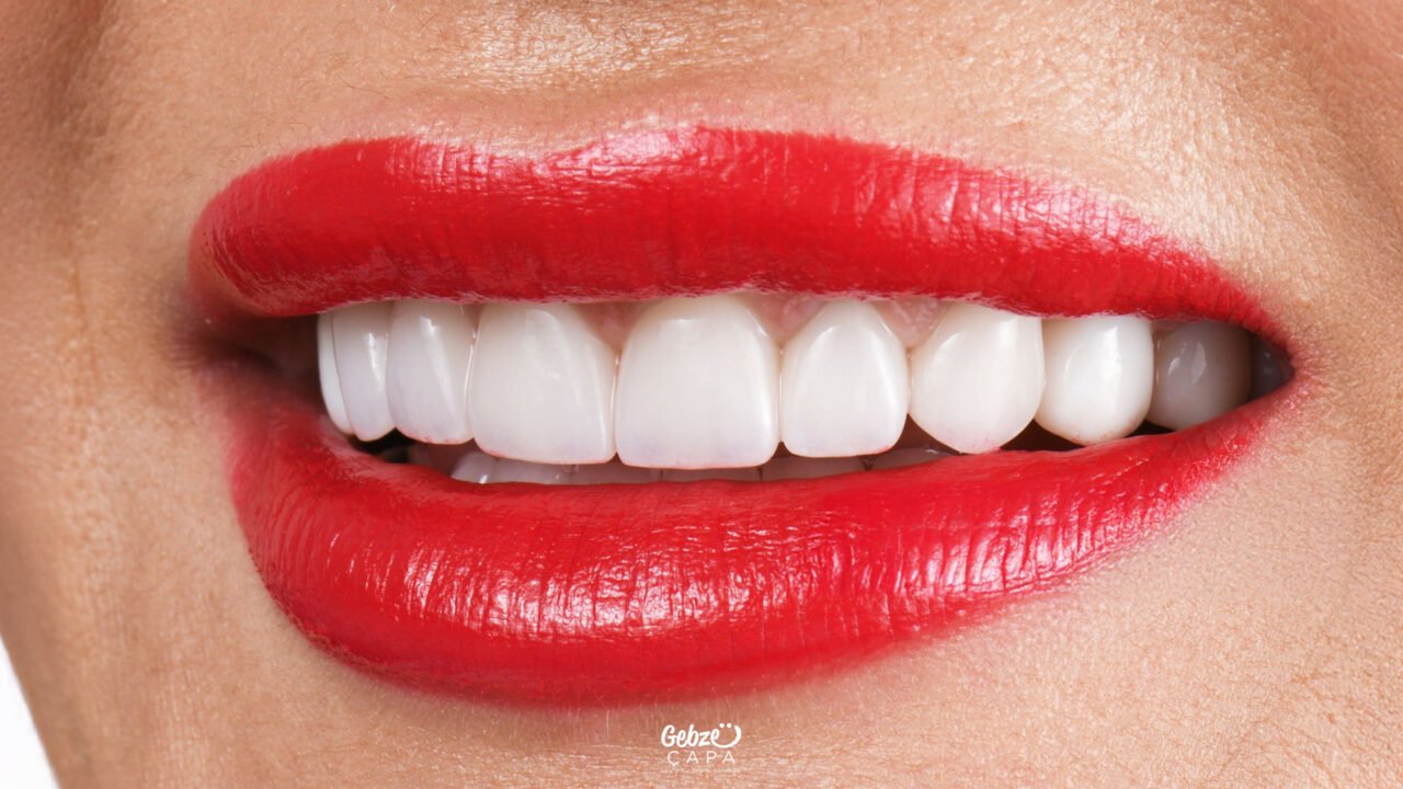 Zirconium Dental Crown