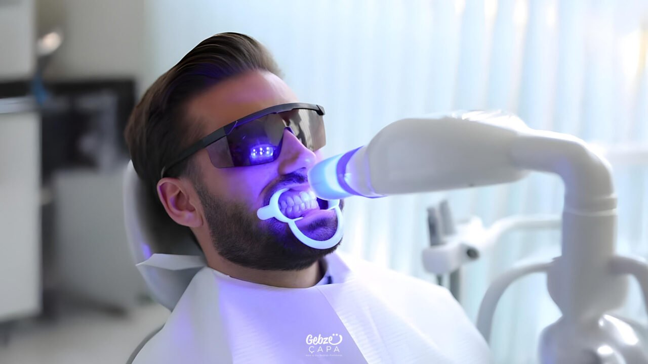 Teeth Whitening