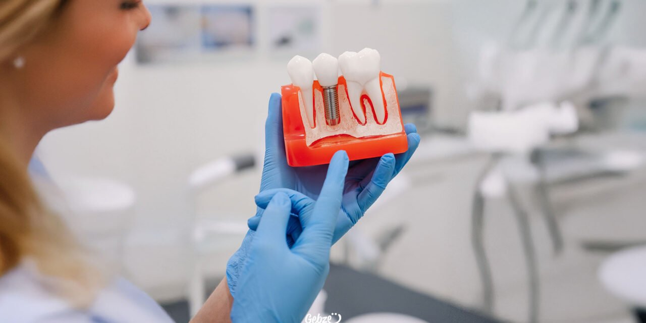 İmplant Tedavisi