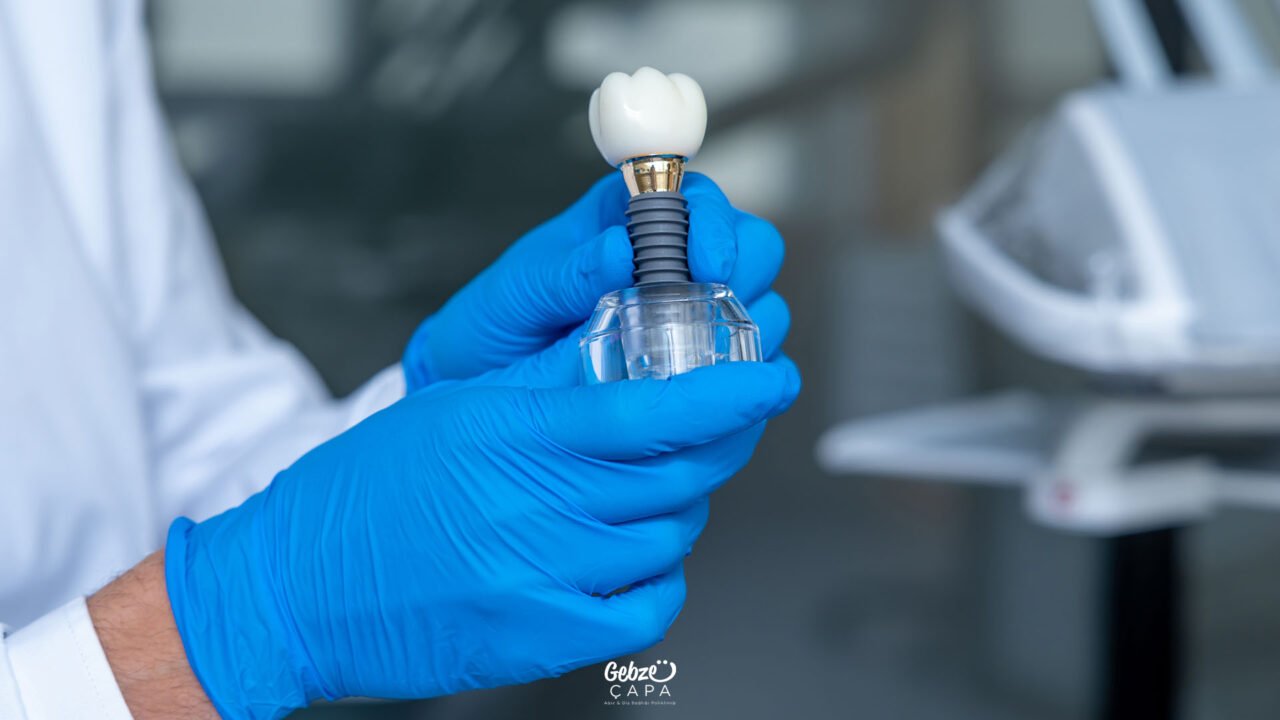 Implant Treatment