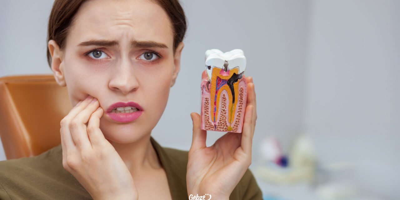 Diş Kökü İltihabı Nedir, Nasıl Tedavi Edilir?