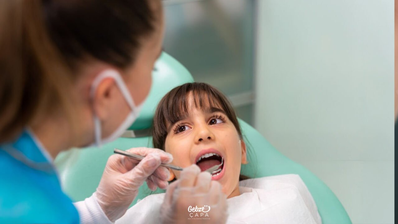Do Filled Teeth Decay