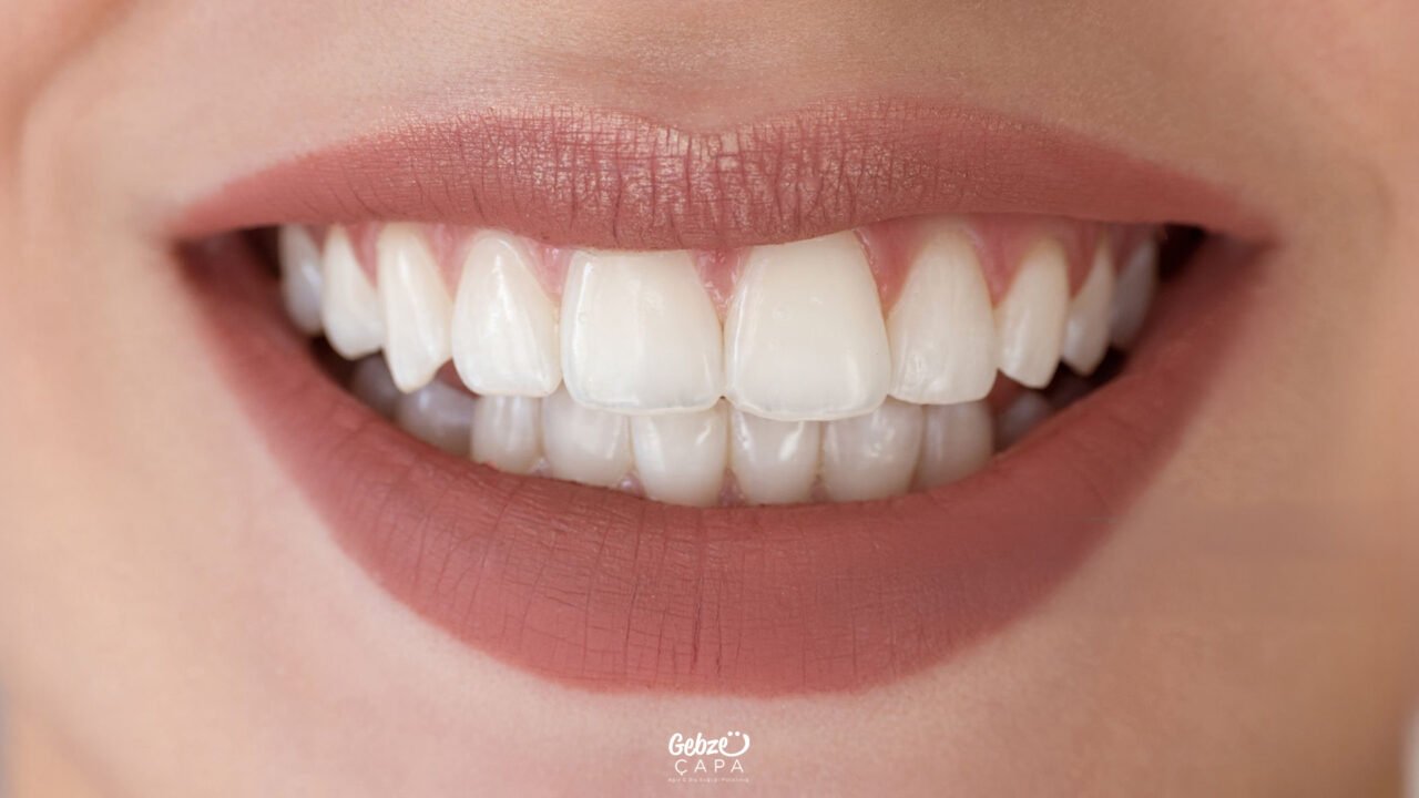 Types of Dental Fillings