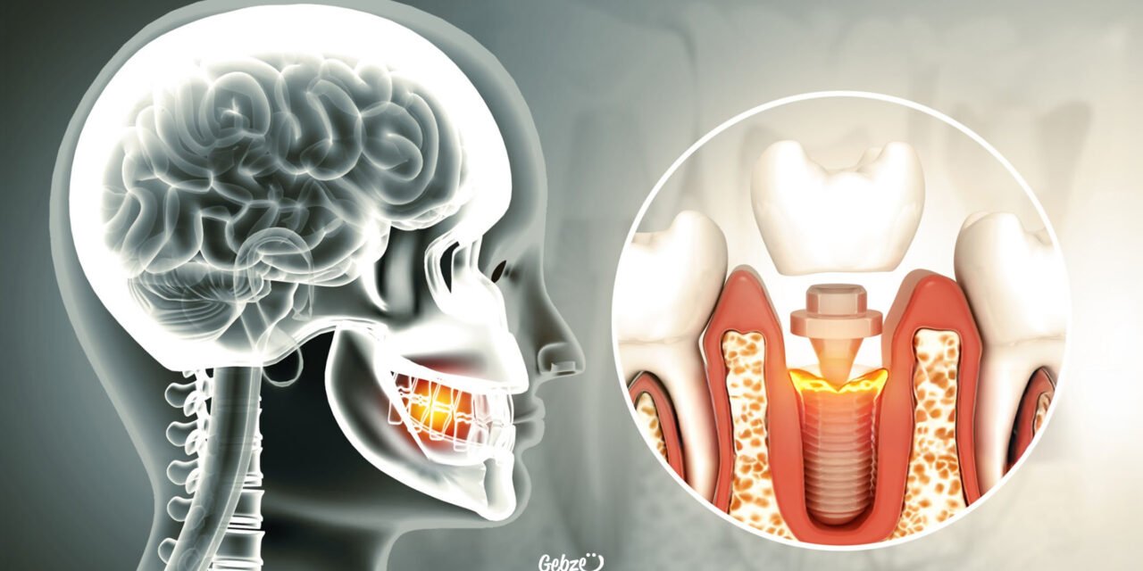 İmplantı Olan MR Çektirebilir Mi?