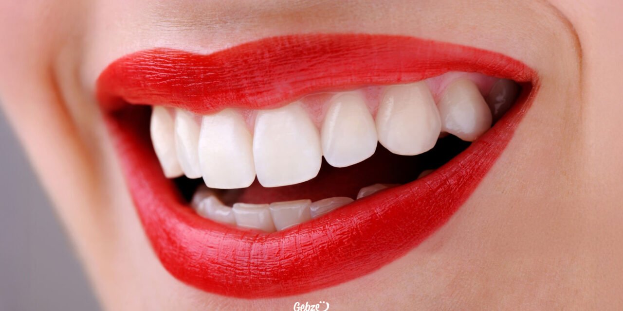 Zirkonyum Kaplamaların Bakımı Nasıl Yapılır?