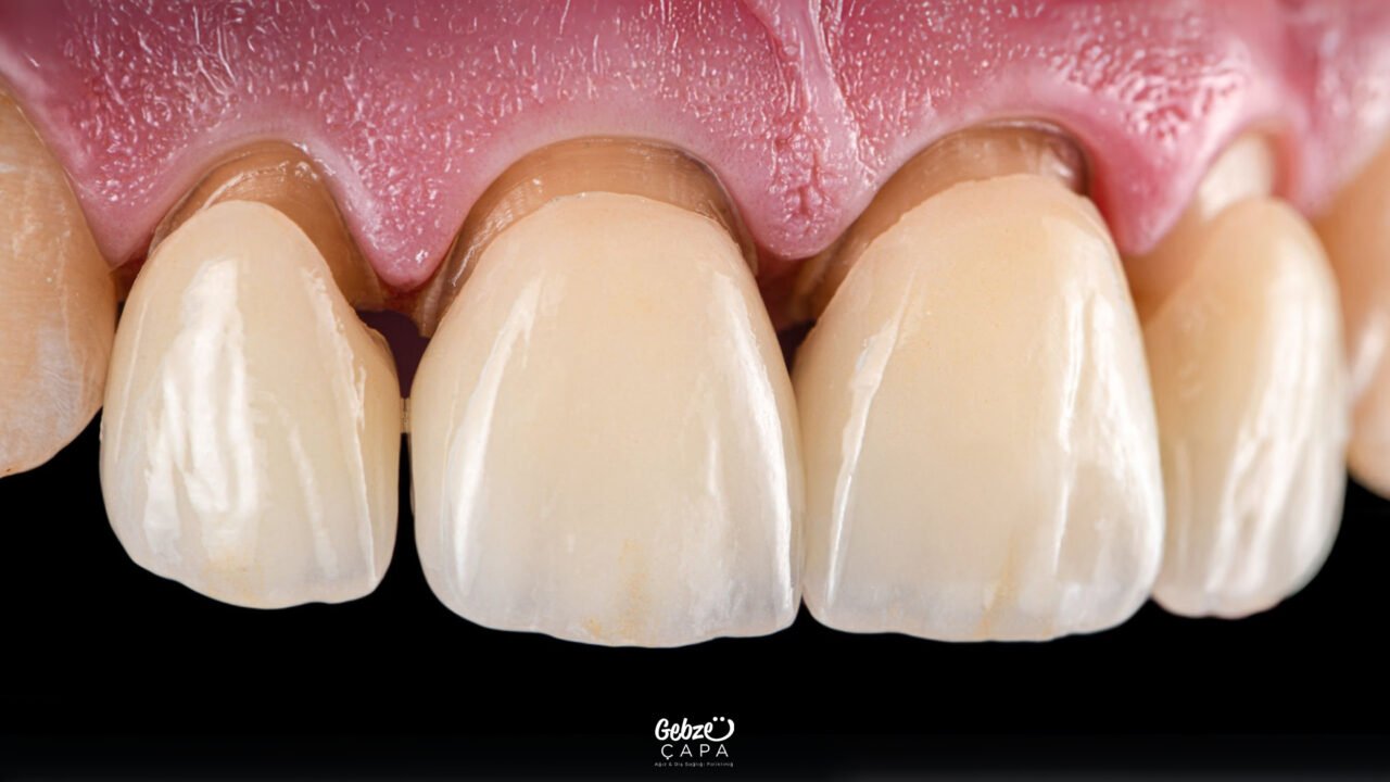 What Is Leaf Zirconium