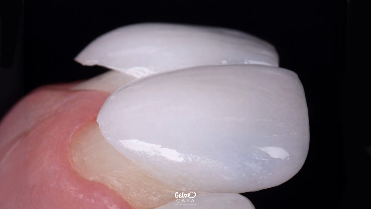 What Is Leaf Zirconium