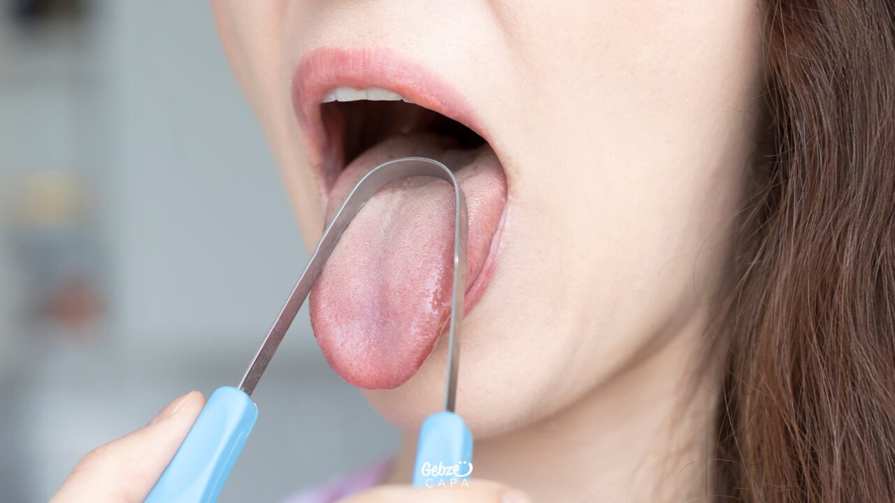 How to Clean Your Tongue